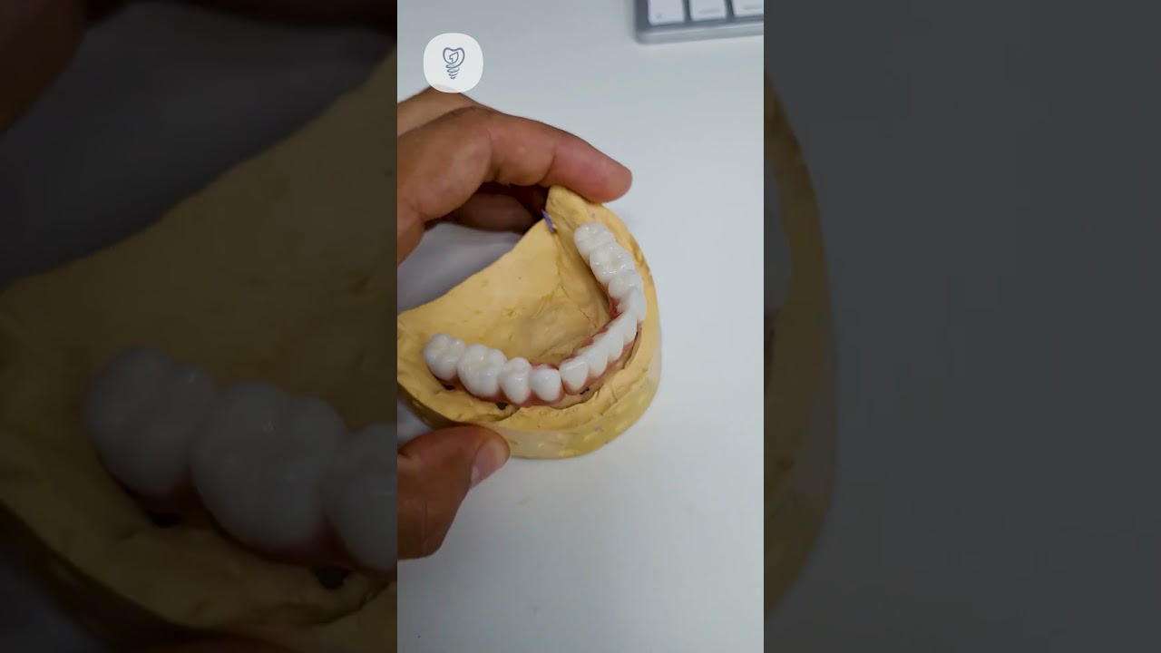 Лазер Цирконий и Красота. Возможности современной соматологии. Имплантация зубов.