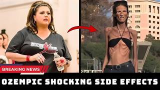 35 Ozempic Face Before & After 2026 | Celeb Weight Loss, Side Effects, Transformations #2