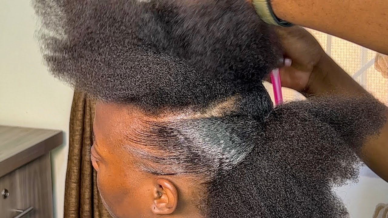 How To BOOST And Grow Back Your DAMAGED HAIRLINE . Natural Hair. YouTube