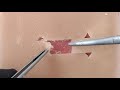 Hplasty training  myocutaneous simulator for teaching suture and reconstructive surgery
