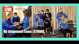 FULL VIDEO ; 123 GO - Chris Leong RE-alignment for STROKE problem ( LIVE 2022-12-10 )