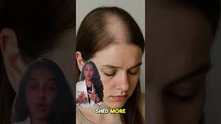 Famous Hair falling out? 🥲 It might not be stress—it could be iron deficiency! 🩸 Profile