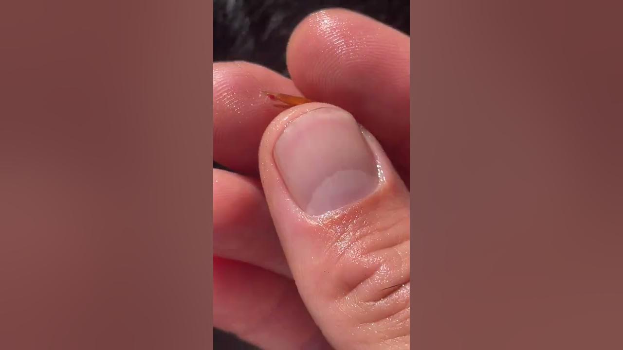 foxtail-in-dogs-paw-natural-remedy-for-early-removal-youtube