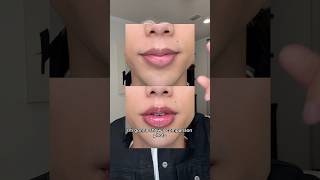 Famous trying an EXTREME lip plumper from Korea 👄 Net Worth