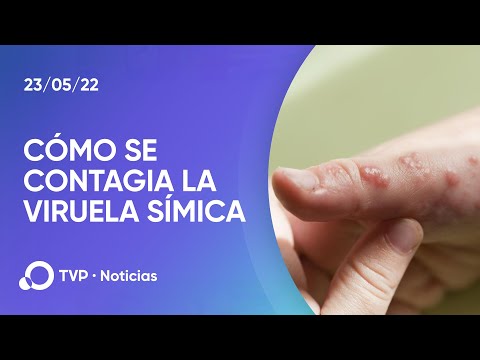 Vídeo: Com es contagia la verola?