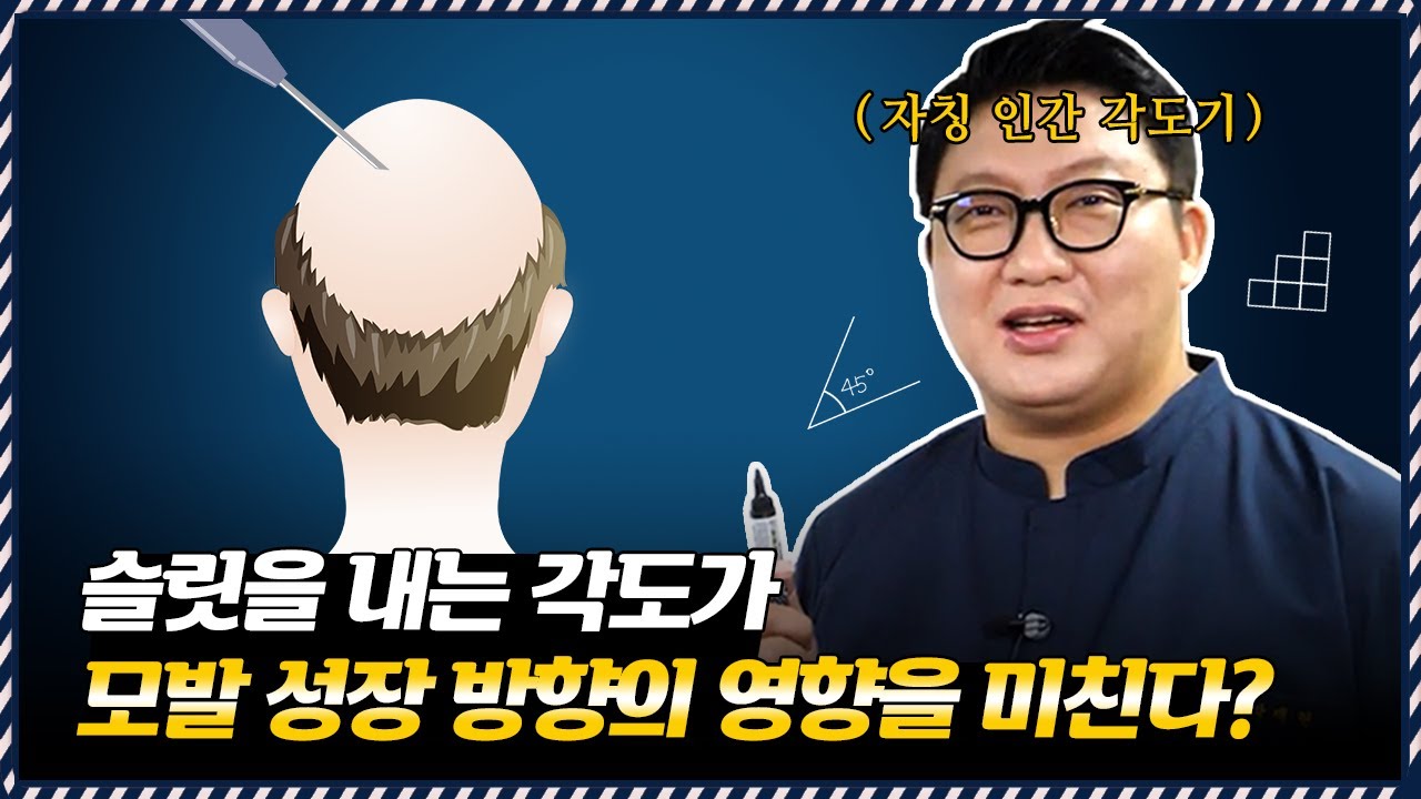 의느님답변📂이식모가 자라는🌲방향은 모발의 성장 벡터📊 보면 알 수 있다? Part.2ㅣ다나성형외과(DANA)ㅣ모발이식ㅣ헤어라인교정ㅣ두피문신ㅣ탈모치료