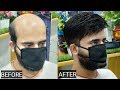 Hair patch, clipping, tapping, bonding, fixing, hair replacement, in Delhi by anas sheikh,9650914665