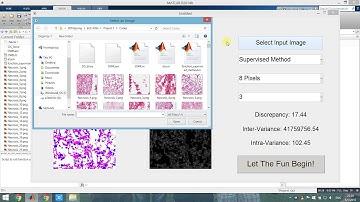 BMED/ ECE 4783 Project Module 1 Demo