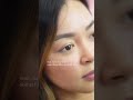 Who knew a tiny crease could make SUCH a big difference? 👀 Watch my double eyelid journey unfold!