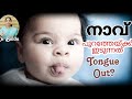       protruded tongue in childrendrbindu