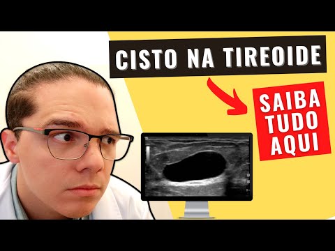 Vídeo: Cisto Colóide Da Glândula Tireóide: Causas, Tratamento