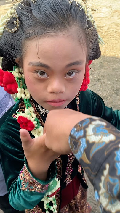 kartini dan kartono #downsyndrome #guruvirall #semogaharimuseninterus