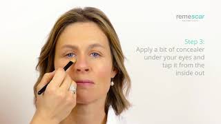 remescar sagging eyelids