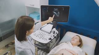 Pregnancy Ultrasound Timeline: What to expect !