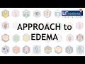 Approach to edema