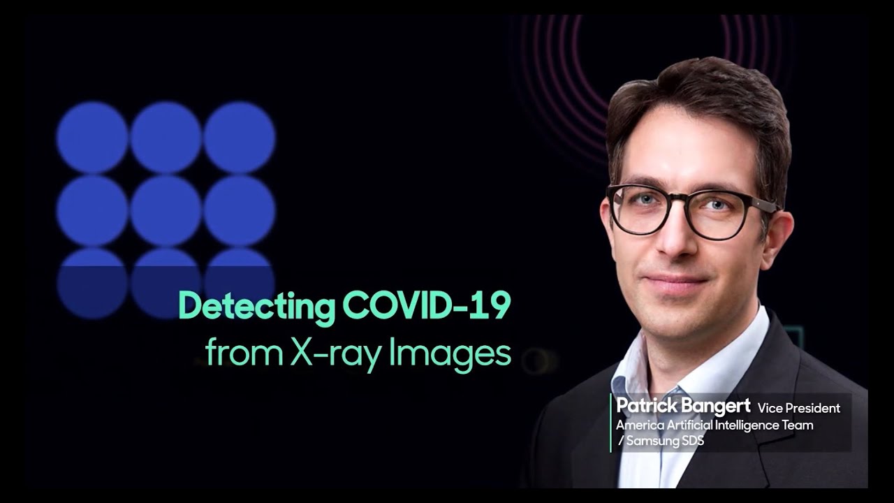 Detecting COVID-19 from X ray Images