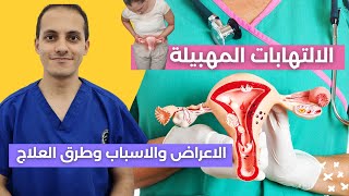 الالتهابات المهبلية اثناء الدورة الشهرية  التشخيص والعلاج مع د/ محمد بدر