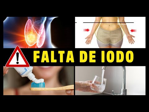 9 SINTOMAS PERIGOSOS da FALTA de IODO e os riscos da SUPLEMENTAÇÃO EXCESSIVA (LUGOL)! Dr Alain Dutra