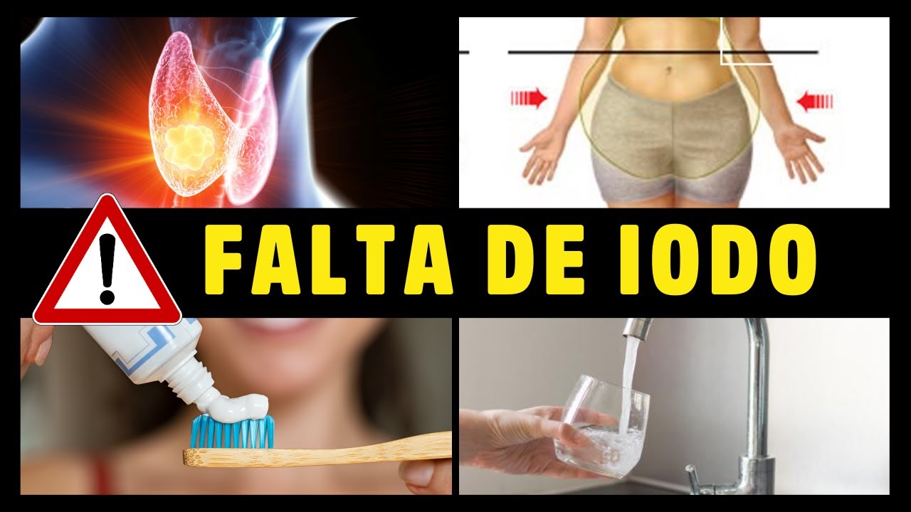 9 SINTOMAS PERIGOSOS da FALTA de IODO e os riscos da SUPLEMENTAÇÃO EXCESSIVA (LUGOL)! Dr Alain Dutra