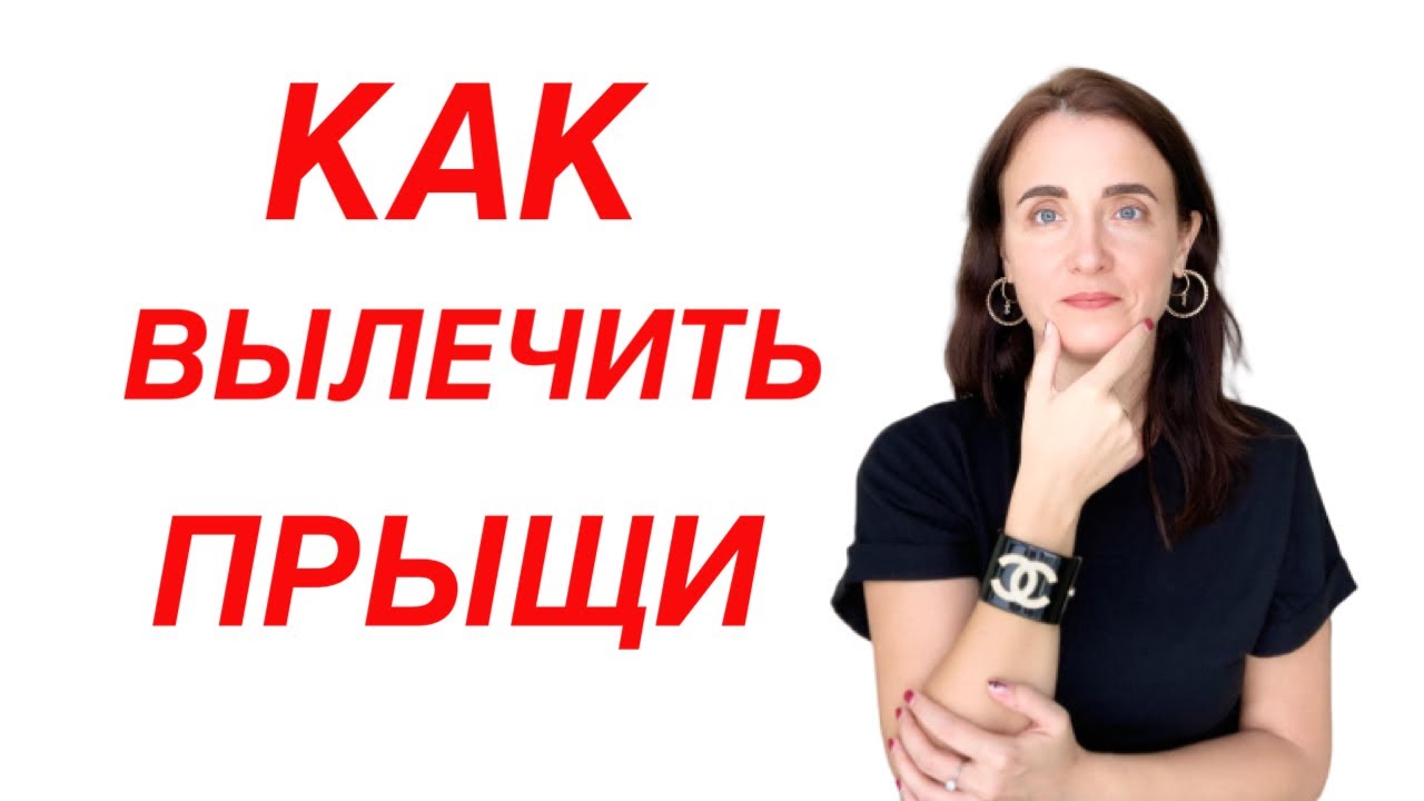 КАК ВЫЛЕЧИТЬ ПРЫЩИ У ГИНЕКОЛОГА? Убрать акне у гинеколога - YouTube