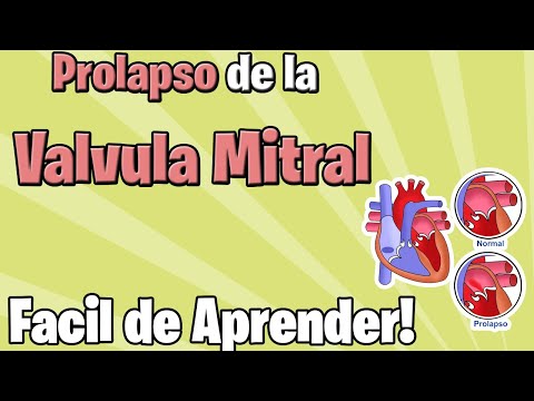 Vídeo: Prolapso De La Válvula Mitral (MVP): Síntomas, Tratamientos Y Más