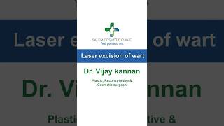 Laser Excision of Wart  cosmeticclinic lasertreatment laserexcision wartremoval laserremoval