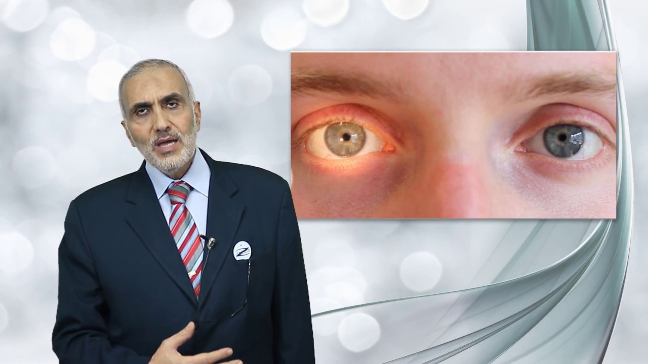 Elbromboly Basic ophthalmology IC Uvea Pupil YouTube