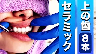 大将　セラミック　2本 mqdefault.jpg