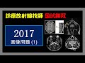 【診療放射線技師国家試験】 2017画像問題 (1)