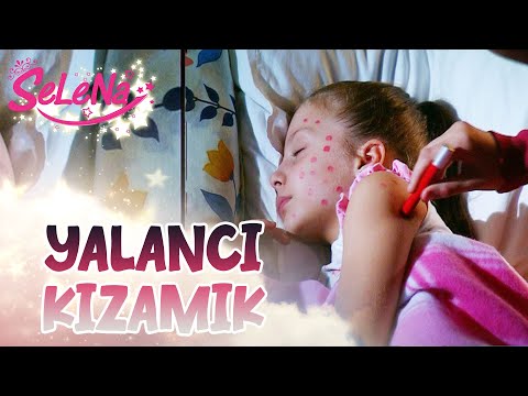 Aslı ve Kıvılcım'ın sahte kızamık oyunu - Selena kolajlar