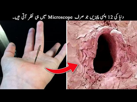 12 Things You Can Only See Under Microscope | TOP X TV
