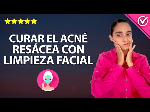 Cómo Curar y Eliminar el Acné Rosácea con una Rutina de Limpieza Facial y Tónicos Caseros ?