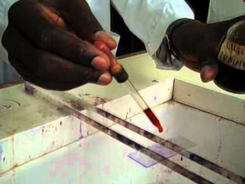 How to Prepare a Gram Stain