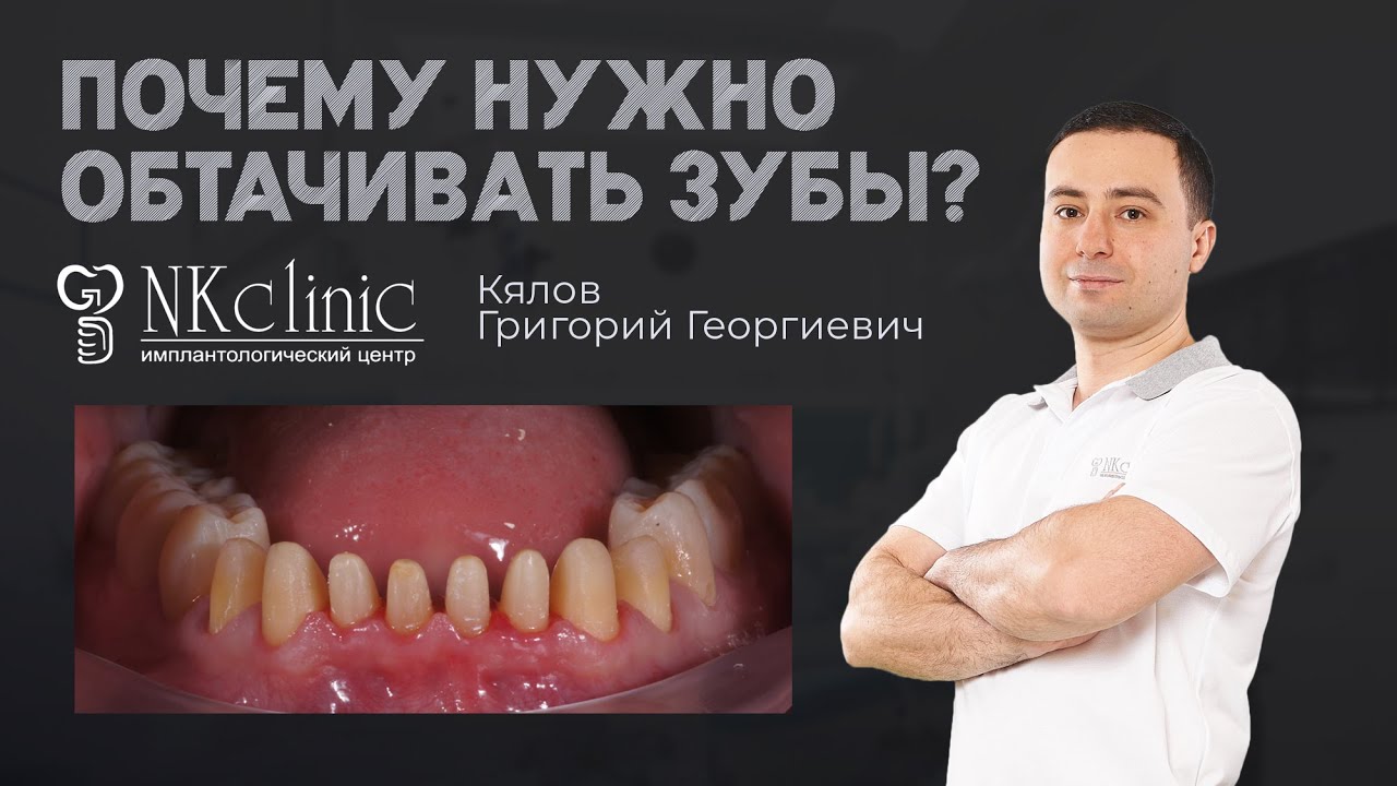 Обтачивают ли зубы перед установкой коронок? - YouTube