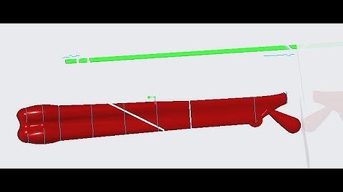 Femur bone Injury fracture by Intramedullary Nailing Orthopedic Surgery Simulation