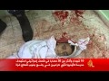 شهداء وجرحى في قصف مدرسة