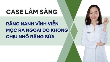 CASE LÂM SÀNG - Răng nanh vĩnh viễn mọc ra ngoài do không chịu nhổ răng sữa