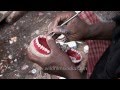 Roadside dentist shows how he makes false teeth