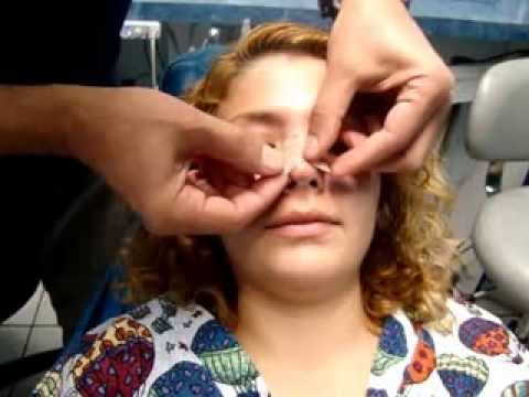 Como colocar cinta micropore en la nariz
