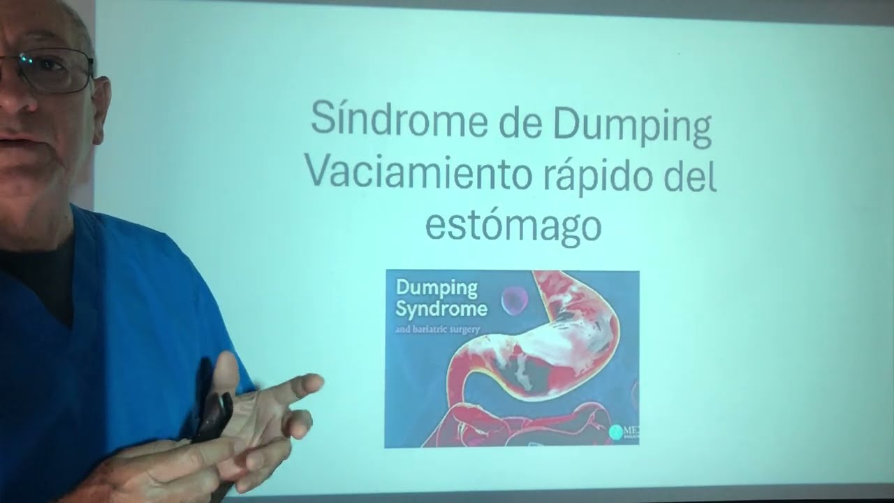 Vaciamiento gástrico rápido. Dumping Syndrome. Shock vasomotor