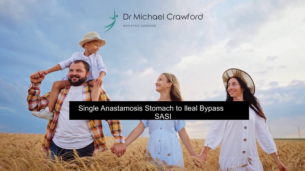 What Is SASI Bypass Surgery? | Dr Michael Crawford Explains This New Weight Loss Option