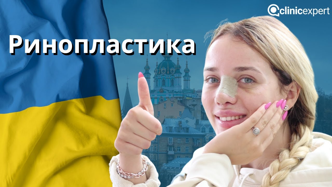 Инна из Украины выбрала Clinicexpert для ринопластики.