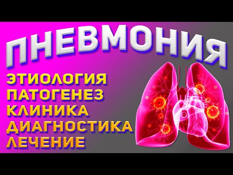 Пневмония - причины, симптомы, лечение