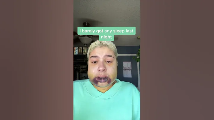 Swelling From Braces or Jaw Surgery? 😳 Orthodontist Reacts... - DayDayNews