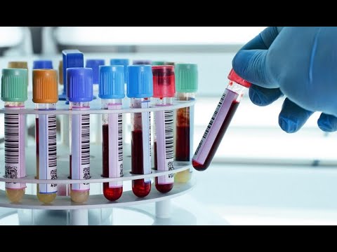 8 გარდაცვლილი, 582ინფიცირებული და 207 გამოჯანმრთელებული - COVID 19 საქართველოში