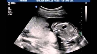 Our baby captured on 11/12/2012 - 2012年12月11日撮影の赤ちゃん