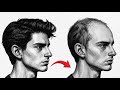 Dear Teenagers, Please Don't Ignore Your Hairline