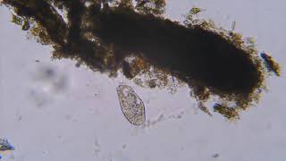 Paramecium Sp. Ve Scenedesmus Sp.