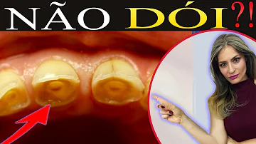 Tem como recuperar dentes gastos?