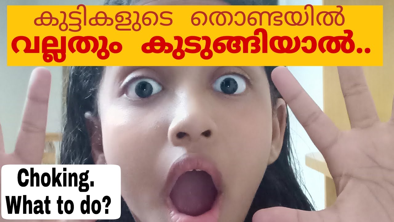 #39 കുട്ടികളുടെ തൊണ്ടയിൽ വല്ലതും കുടുങ്ങിയാൽ എന്തു ചെയ്യണം /Choking in children/what to do/malayalam